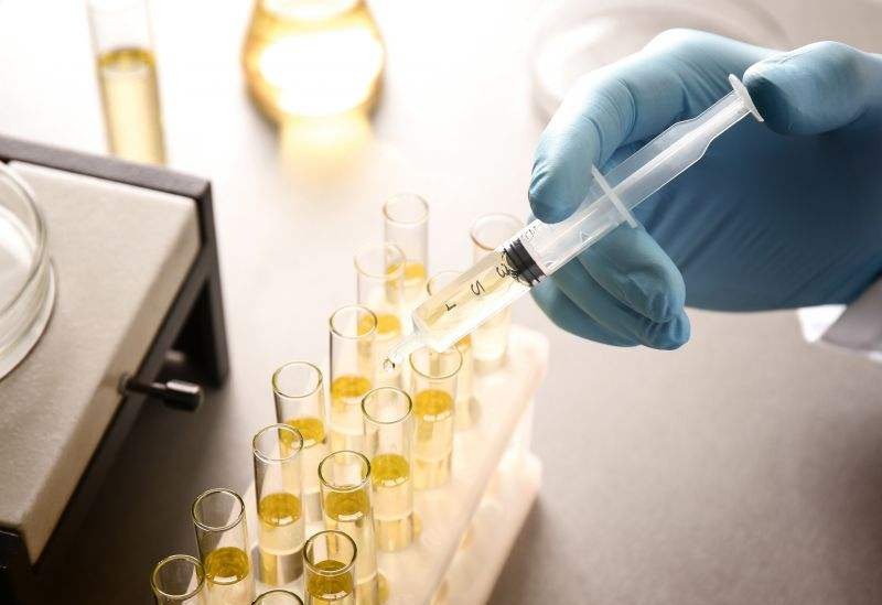 尿檢能檢測出來什么問題？